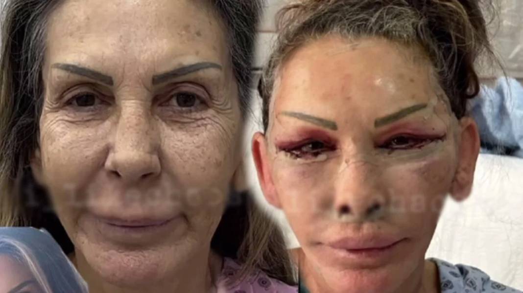 Petek Dinçöz’ün annesini tanıyamayacaksınız. 4 saatte 30 yaş gençleşti - Resim: 4